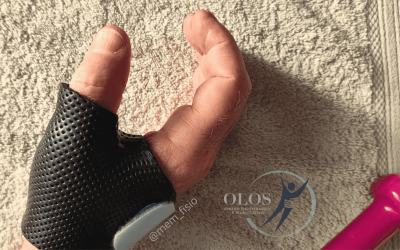 Riabilitazione della Mano e dell’Arto Superiore